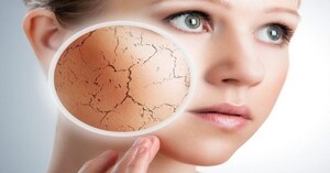 Top 4 kem tẩy da chết bán chạy nhất trên thị trường trong năm 2022