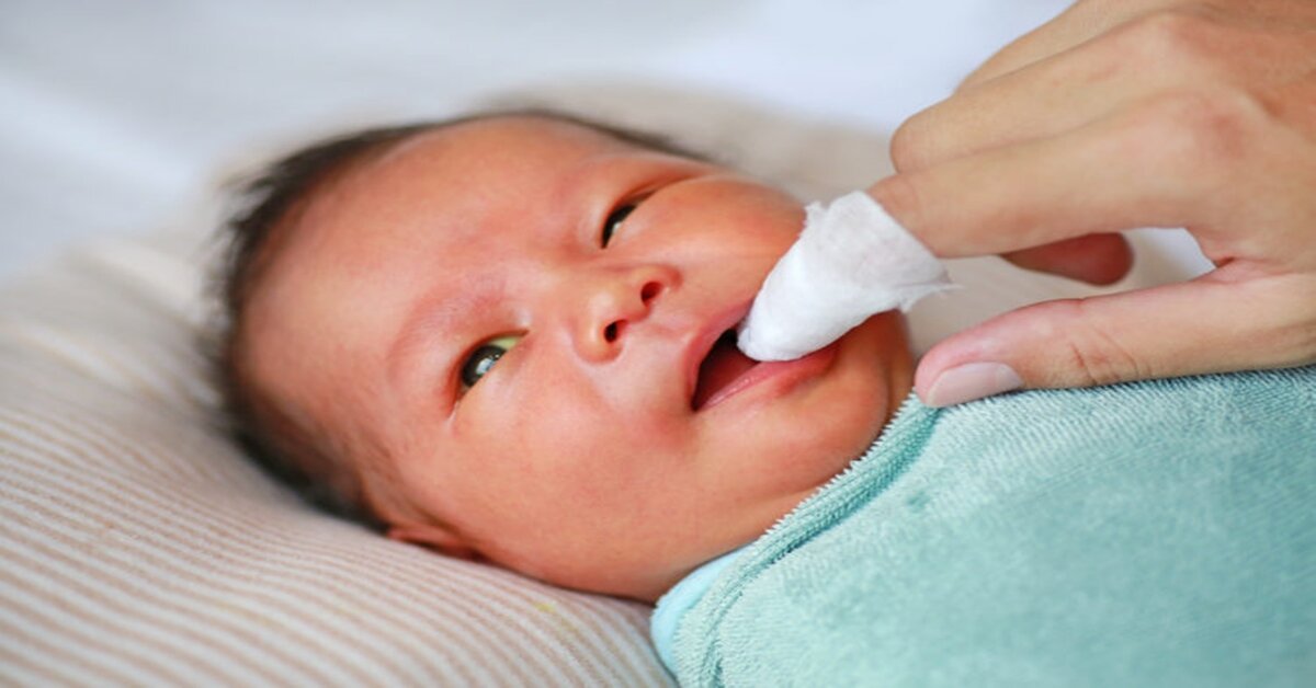 Vệ sinh miệng cho bé hàng ngày để tránh tưa lưỡi như thế nào ?