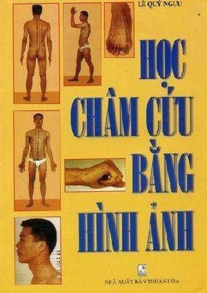 Học Châm Cứu Bằng Hình Ảnh 