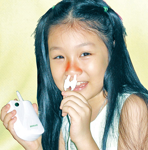 Máy trị viêm mũi dị ứng Syro Bio-Nase (BioNase)