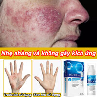 [ CHÍNH HÃNG] OUMANDI Kem bôi nấm da giảm ngứa nhanh. Kentax Kem bôi nấm ngứa nấm da ngứa