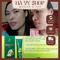 🆘 Combo kem bơ serum 7day olic bộ đôi tái sinh làn da bí kíp xóa sổ mọi khuyết điểm trên da - Chính Hãng