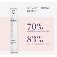 [ CÔNG TY ] Kem mắt Teoxane R[II] Advanced Eyes Contour 15ml cải thiện bọng mắt nếp nhăn