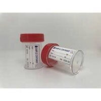 100 ỐNG LỌ ĐỰNG NƯỚC TIỂU XÉT NGHIỆM