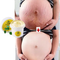 【100% Original】pregnancy Rạn Da Sửa Chữa Kem Điều Trị Cho Mẹ Chăm Sóc Da 100G