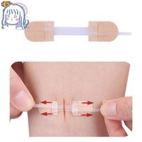 3 Dây Kéo Miếng Dán Đóng Vết Thương Thoáng Khí Liền Mạch Co Giãn Zip Khâu Băng Cho Chăm Sóc Vết Thương Nẹp Hỗ Trợ CEP3