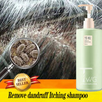380ml Dầu gội trị gàu trị tóc ngứa muối biển Dầu gội trị chấy, Có sẵn cho cả nam và nữ
