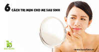 6 cách trị mụn sau sinh hiệu quả nhất dành cho mẹ