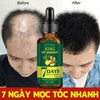 ❤️100% Chính Hãng❤️（Hiệu quả sau 7 ngày）Serum mọc tóc Tinh chất dưỡng tóc Tinh Chất Chống Rụng Tóc 30ml kích thích mọc tóc nhanh làm dàygiúp giảm rụng tóc giải quyết vấn đề rụng tóc do lão hóa / hói đầu sau sinh