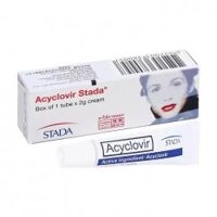 Acyclovir Stada 2g - Kem trị virus Herpes Simplex