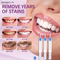[Ayunga] Phòng khám nha khoa Dual Barrier Gel làm trắng răng 35 Hydro Peroxide Gel tẩy trắng răng 2.5ML / 5ML [VN]