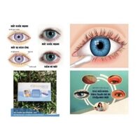 Băng và miếng chườm ấm mắt [chính hãng]