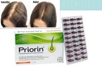 BAYER PRIORIN 120 VIÊN THUỐC MỌC  TÓC VÀ CHỐNG RỤNG  TÓC CỦA  ĐỨC