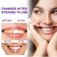 Bee Venom Oral Cleaning Toothpaste Dazzling White Stain Gums Tooth Whitening Gums Toothpaste