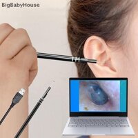 Bigbabyhouse USB Làm sạch tai nội soi HD Visual Earpick với máy ảnh Mini QC Vn