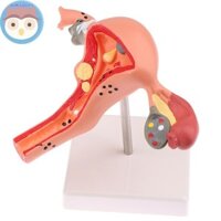 Bình 1 Cái Đạo Cụ Y Tế Mô Hình Bệnh Lý Uterus Ovary Mô Hình Giải Phẫu Phần Chữ Thập Công Cụ Nghiên Cứu EN