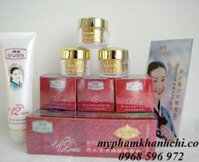 Bộ mỹ phẩm trắng da, đặc trị nám, tàn nhang Dechangkum 888 (4in1)