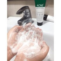 Bộ Sản Phẩm Dành Cho Da Mụn Some By Mi AHA-BHA-PHA 30 Days Miracle AC SOS Kit (4 Món)