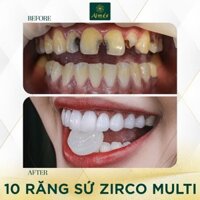 Bọc Răng Sứ Zirconia Multi Giá siêu mềm chỉ 3.500.000đ/răng