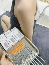 Botulax 200 – hàng Hàn – xách tay