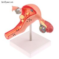 Brifywr 1 Cái Đạo Cụ Y Tế Mô Hình Bệnh Lý Uterus Ovary Mô Hình Giải Phẫu Phần Chữ Thập Công Cụ Nghiên Cứu [VN]