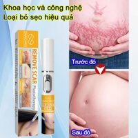 Bút laser xóa sẹo