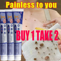 BUY1TAKE2 South Moon Wart Remoal Cream tẩy nốt ruồi, mụn cóc, mụn thịt, sẹo lồi kem ngừa sẹo lồi thâm sẹo rỗ lâu năm các