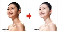 Cách Làm Trắng Da Cho Người Đang Uống Thuốc Lao An Toàn