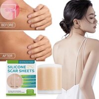 Cagjb 150 / 300 Cm Silicone Gel Scar Sheet Miếng Dán Điều Trị Loại Bỏ Băng Mụn Chấn Thương Đốt Cháy Sẹo Che Da Phần Sửa Chữa Tai Làm Đẹp N