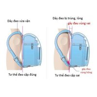Cặp chống gù lưng nhật bản trẻ em G[Hot
