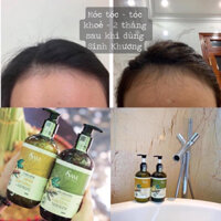 Cặp dầu gội gừng xả Sinh Khương Sam Natural - Dầu gội mọc tóc ngăn rụng tóc 500ml