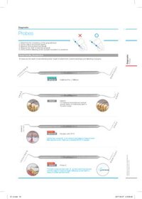 Cây đo túi nướu  - Osung