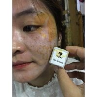 Chấm Tàn Nhang Yody White Phương Anh