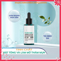 [CHÍNH HÃNG 100%] Serum ngừa mụn thâm kiềm nhờn và phục hồi dưỡng trắng da Detoxblanc-Peel acnes