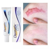 [CHÍNH HÃNG] Dermatix Ultra Gel Làm Mờ Sẹo Thâm, Sẹo Lồi 15g