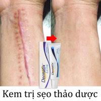 ⭐CHÍNH HÃNG⭐ Gel Kem Làm Mờ Sẹo Thâm, Sẹo Lồi ,trị sẹo15g Xóa vết rạn da Sửa chữa vết sẹo mạnh mẽ Vết sẹo bỏng