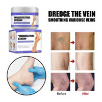 [Chính Hãng] Kem Bôi Varicose Veins Cream
