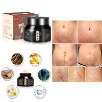 (Chính hãng) Kem xoá sẹo thâm lồi, bỏng, thủy đậu, rạn da sau sinh , vết thâm mặt cải thiện làn da sáng mịn hiệu quả
