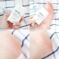 (Chính hãng) Thành lăn mềm gót chân phục hồi chân nứt nẻ 22g Hàn Quốc