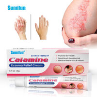 ❤[CHÍNH HÃNG] Thuốc Mỡ Calamine Shiduqing Để Giảm Ngứa Và Chăm Sóc Da