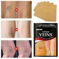 Combo 12 Miếng Dán Suy Giãn Tĩnh Mạch Varicose Relief Patch Nhập Khẩu Chính Ngạch