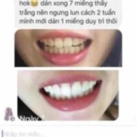 Combo 14 miếng (7 gói/7 ngày) dán trắng răng Crest 3D White Whitestrips loại Professional Effects - Mỹ