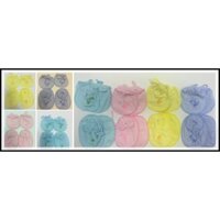 Combo 5 bộ bao tay bao chân buộc dây cho bé sơ sinh