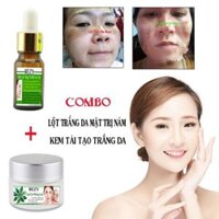 COMBO KEM LỘT TRẮNG DA NÁM