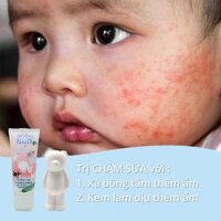 Combo kem trị chàm sữa Bio Bio Baby