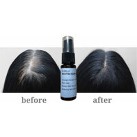 Combo mua 3 tặng 1 XỊT MỌC TÓC Si BELLI BIOTIN trị rụng tóc