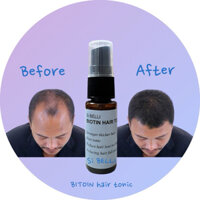Combo mua 5 tặng 2  Si BELLI serum MỌC TÓC BIOTIN hair tonic trị hói đầu, rụng tóc, tóc thưa siêu hiệu quả