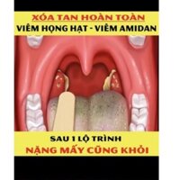 [Date mới ] xoá tan hoàn toàn viêm họng hạt, amidan hốc mủ