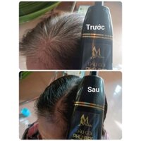 Dầu Gội Đen Tóc (Phủ bạc)