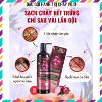 DẦU GỘI HÀNH TÂY ĐỎ ARIS, HÀNH TRI CHẤY VOJO HỖ TRỢ GIẢM CHẤY - liulyshop681102